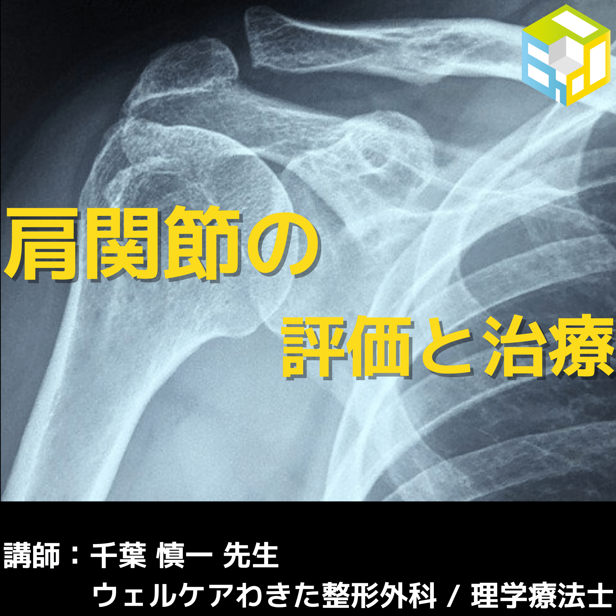 肩関節の評価と治療｜肩関節周囲炎・腱板断裂に対する治療を学ぶ#1262