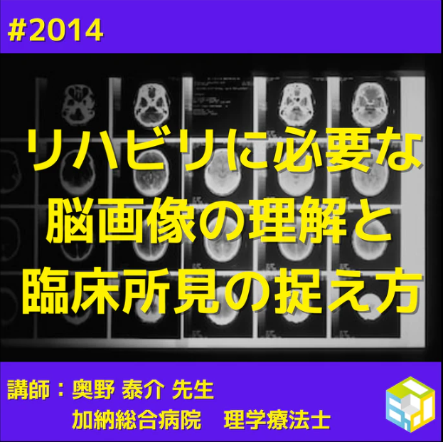 リハビリに必要な脳画像の理解と臨床所見の捉え方｜姿勢制御・歩行障害・Pusher症候群 ｜医療 看護 介護のセミナー・研修情報サイト メデュケーション