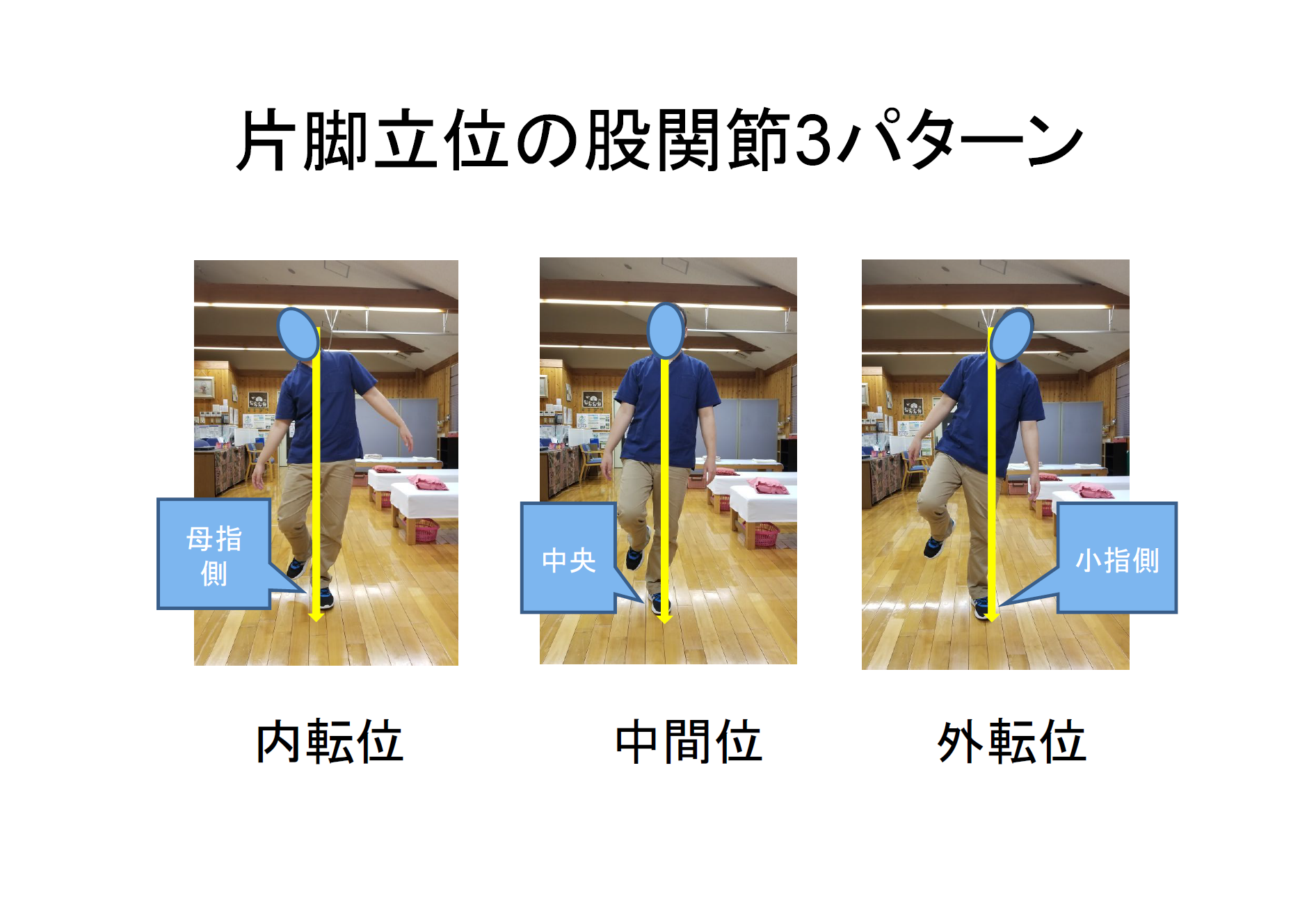 新人セラピスト向け】 理学・作業療法士のための臨床動作分析 ～歩行動作におけるメカニカルストレスの評価と運動療法～ ｜医療 看護  介護のセミナー・研修情報サイト メデュケーション