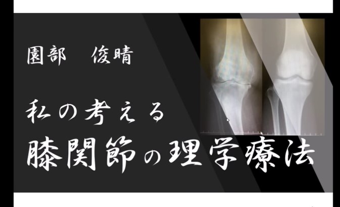 園部俊晴先生】 私の考える膝関節の理学療法 （仮説検証の実際